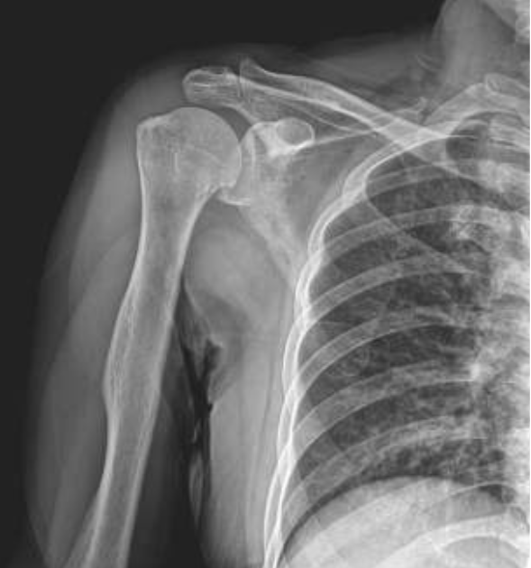 Sin%20título%20%286.7%20×%208.6&nbsp;cm%29%20%286.7%20×%206.1&nbsp;cm%29%20%285.7%20×%206.1&nbsp;cm%29